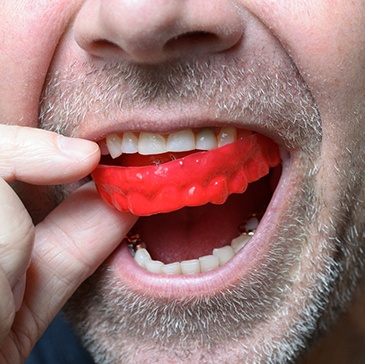Man with grey facial hair inserting red mouthguard